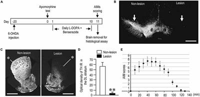 Dopamine-Induced Changes in Gαolf Protein Levels in Striatonigral and Striatopallidal Medium Spiny Neurons Underlie the Genesis of l-DOPA-Induced Dyskinesia in Parkinsonian Mice